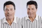 ¿Qué te hiciste en la cara?, la pregunta de sus fans a Chayanne