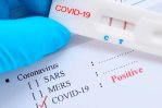 Casos activos de COVID-19 descienden a 411 en República Dominicana