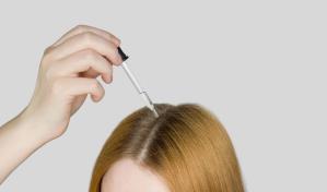 Caída del cabello: todo lo que debes saber sobre el minoxidil
