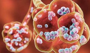 Científicos utilizan robots para tratar la neumonía bacteriana en los ratones