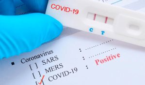 República Dominicana registra 511 casos activos de COVID-19