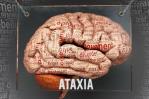 La ataxia, un trastorno que suele causar caídas