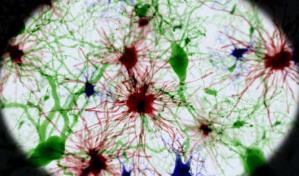 No sacar la “basura cerebral” contribuye al desarrollo del alzhéimer