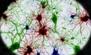No sacar la “basura cerebral” contribuye al desarrollo del alzhéimer