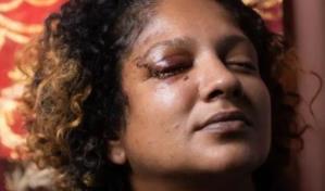 "¿Sabes lo asustada que estoy ahora?, pregunta la mujer que recibió brutal paliza en metro de NY