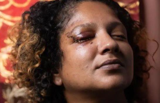 “¿Sabes lo asustada que estoy ahora?, pregunta la mujer que recibió brutal paliza en metro de NY