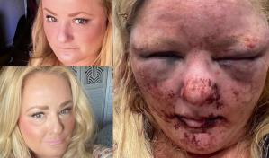 Mujer es atacada y violada por un vagabundo en California
