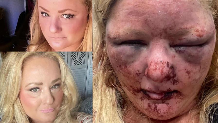 Mujer es atacada y violada por un vagabundo en California Mujer es atacada y violada por un vagabundo en California