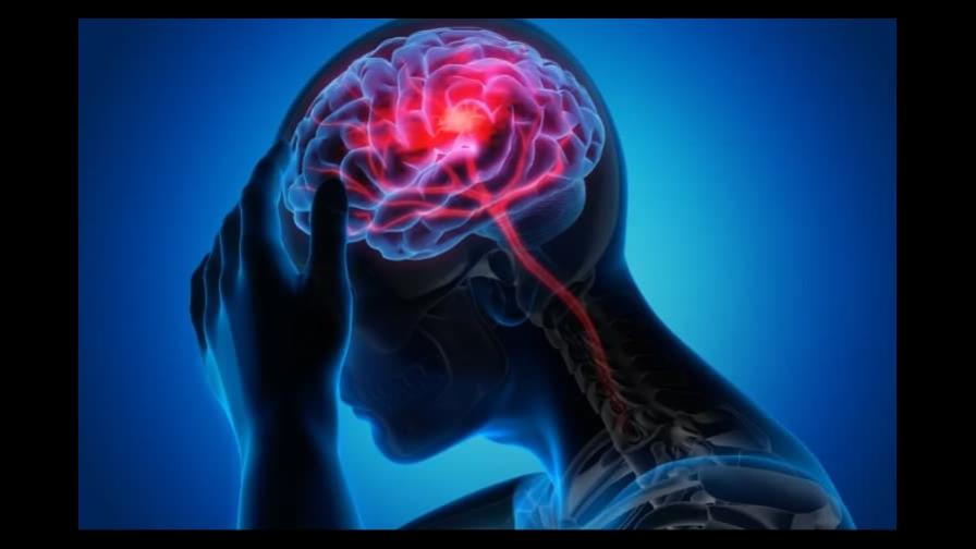 Cómo identificar un accidente cerebrovascular