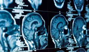 Unos 300 neurocientíficos se reúnen en España para hablar del cerebro