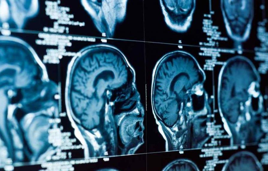 Unos 300 neurocientíficos se reúnen en España para hablar del cerebro