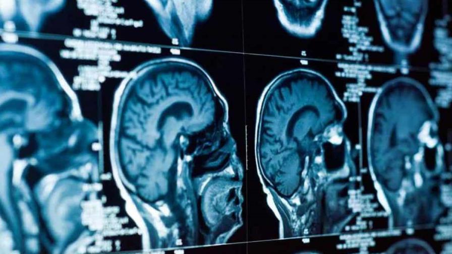 Unos 300 neurocientíficos se reúnen en España para hablar del cerebro