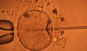 Un estudio apoya hipótesis de disminución mundial de concentración de espermatozoides