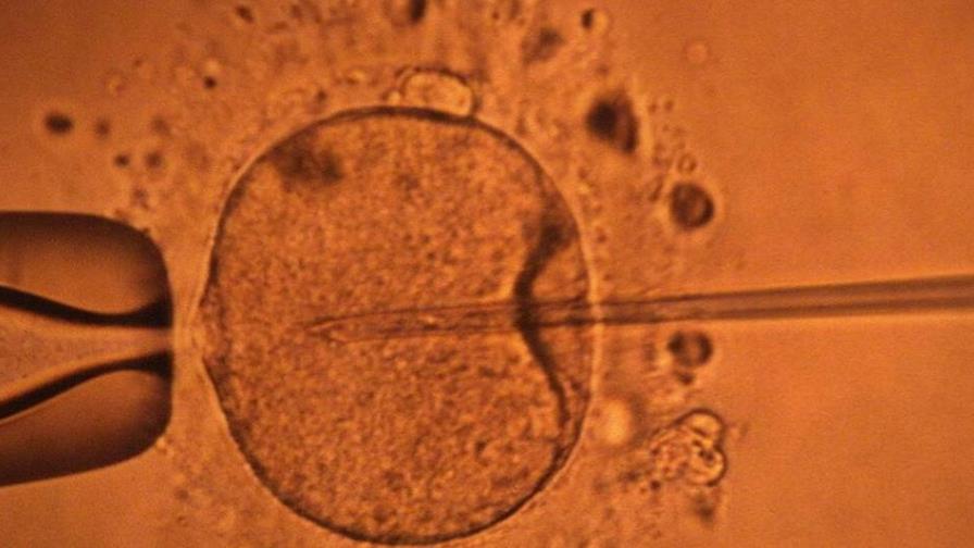 Un estudio apoya hipótesis de disminución mundial de concentración de espermatozoides