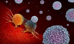 Identifican proteína que impide que inmunoterapia contra el cáncer funcione