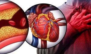 El colesterol bueno no lo es tanto para predecir enfermedad card&iacute;aca