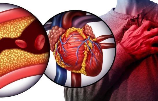 El colesterol bueno no lo es tanto para predecir enfermedad cardíaca