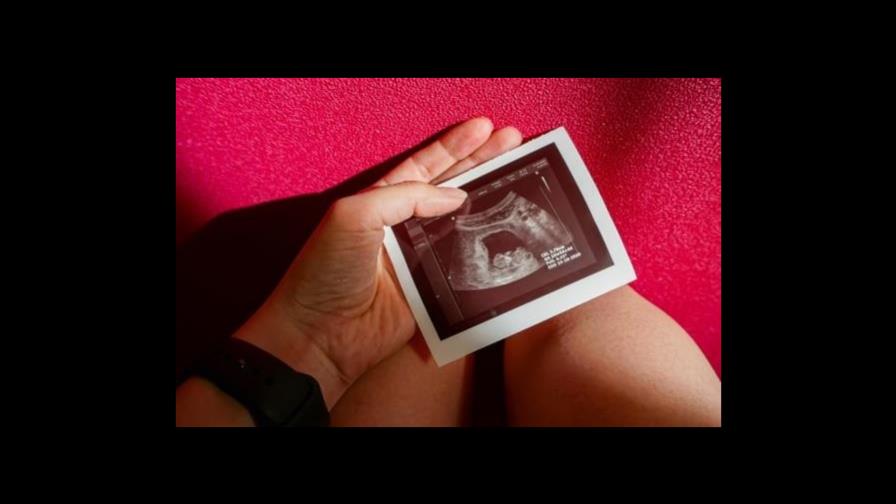 Corte Suprema de Georgia prohíbe el aborto después de la sexta semana Corte Suprema de Georgia prohíbe el aborto después de la sexta semana