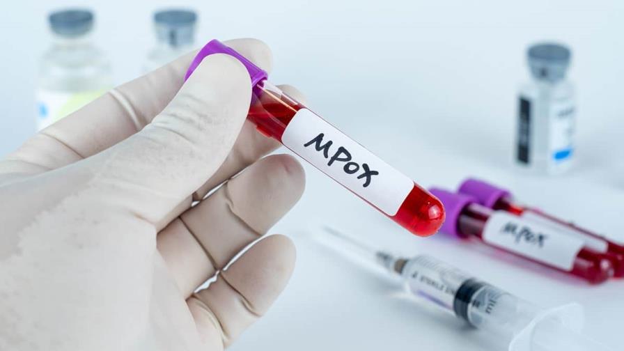 La OMS cambia nombre de la viruela del mono a mpox