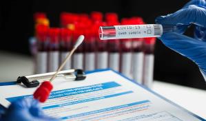 Un error en pruebas de covid en laboratorio brit&aacute;nico pudo causar 20 muertes