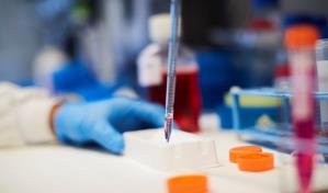 Ensayarán nueva molécula en personas down para mejorar rendimiento cognitivo Ensayarán nueva molécula en personas down para mejorar rendimiento cognitivo