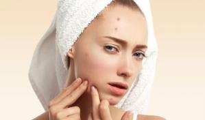 La ola de calor que vive el país puede activar de manera severa el acné