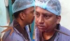 Hombre sobrevive tras ser apuñalado en el cuello con un tridente de 1.5 pies