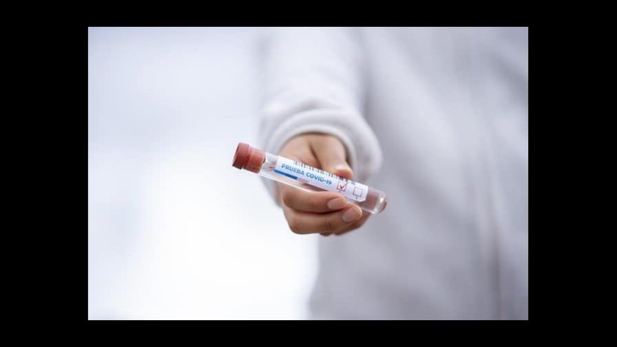 República Dominicana registra 2,072 casos activos de COVID-19