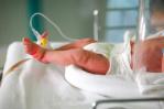 El 90 % de bebés prematuros en mayor riesgo por virus sincicial respiratorio El 90 % de bebés prematuros en mayor riesgo por virus sincicial respiratorio