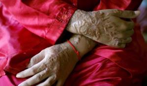 Indignación por el ataque con ácido a una joven de 17 años en Nueva Delhi