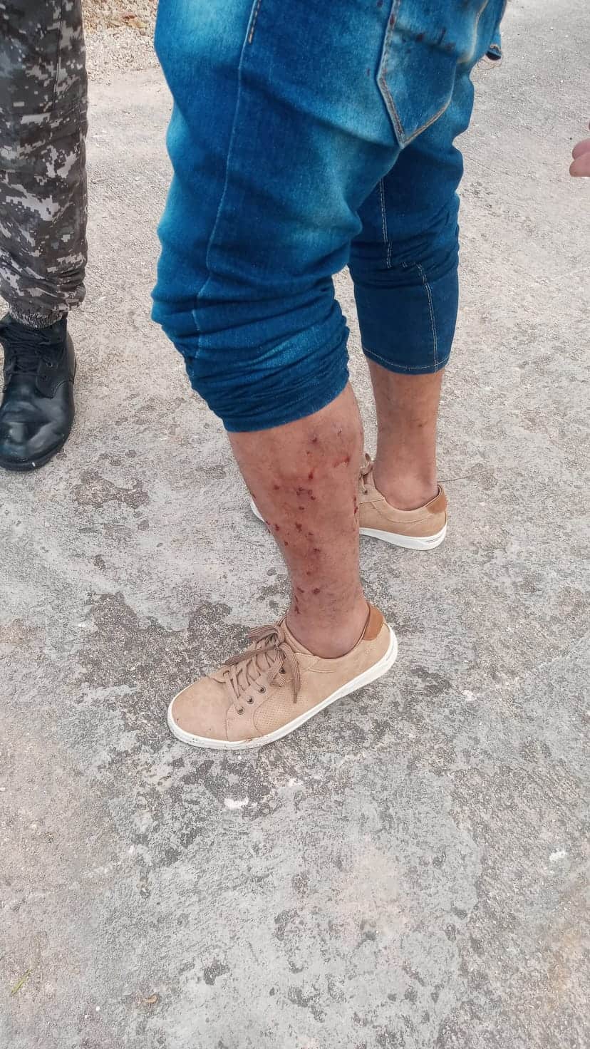 Herido durante el motín.