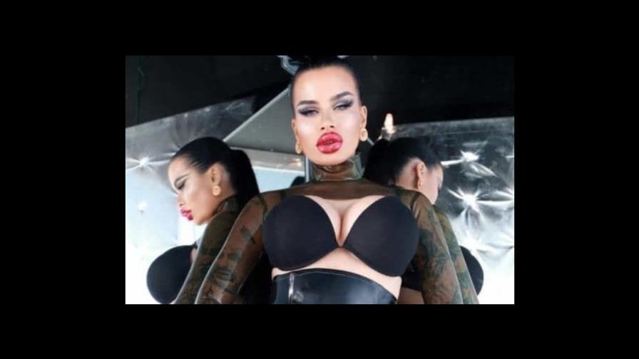 Mujer gasta más de US$48,000 en relleno de labios