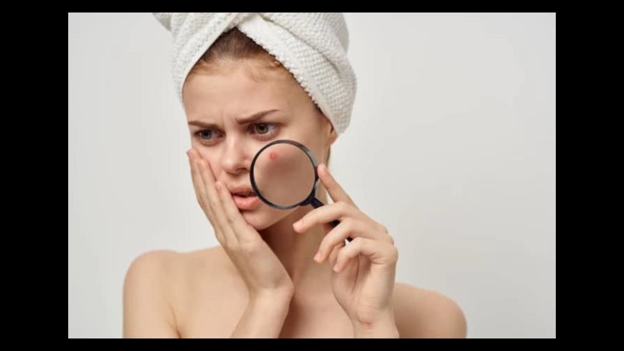 Acné: cómo maquillarte en estas ocasiones