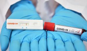 Salud reporta 342 casos activos de COVID-19