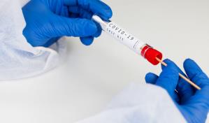 Costa Rica alerta a poblaci&oacute;n ante aumento en casos de Covid-19