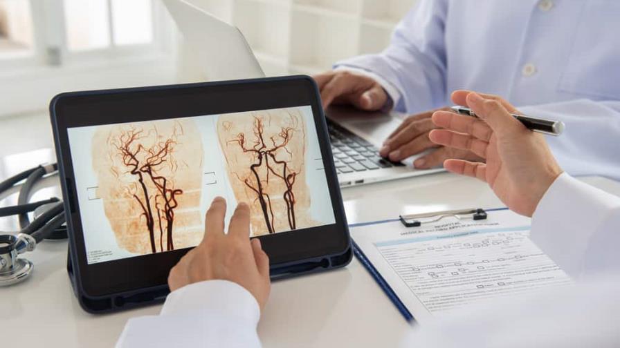 La inteligencia artificial reduce el riesgo de secuelas por un derrame cerebral