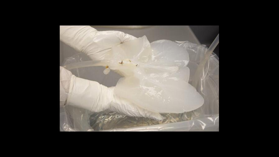 Modifican hígados de cerdo para aliviar escasez de órganos