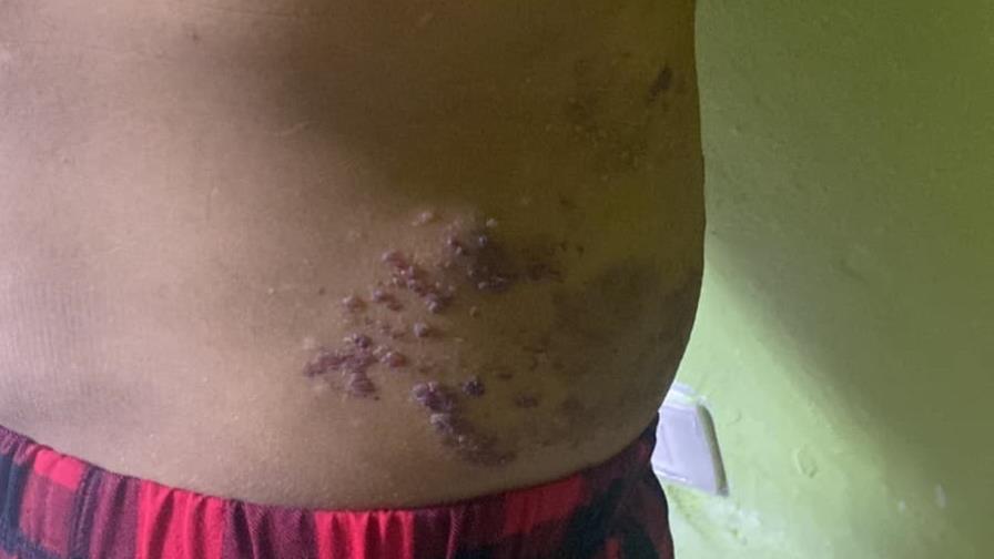 Madre pide ayuda para costear estudios y tratamiento médico de su hija