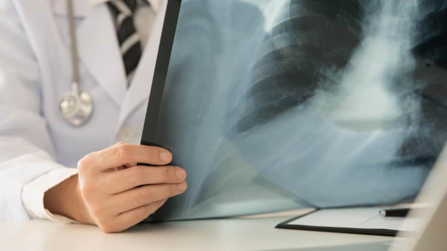 El Salvador suma 1,202 muertes por neumonía y 24,459 casos a diciembre 2022