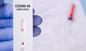 Rep&uacute;blica Dominicana registra 341 casos activos de COVID-19