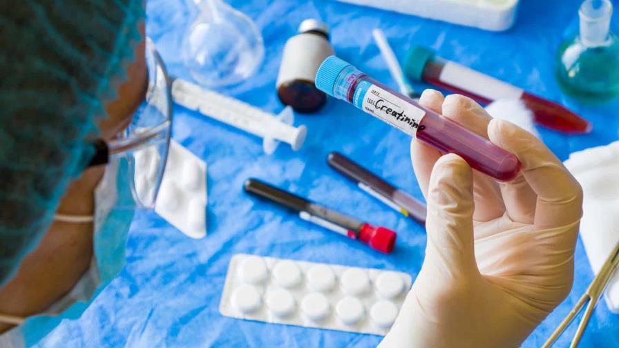 Doctora, mi creatinina está alta. ¿Qué debo hacer? Doctora, mi creatinina está alta. ¿Qué debo hacer?