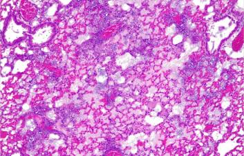 Una píldora con una bacteria vence la resistencia a antibióticos en neumonías