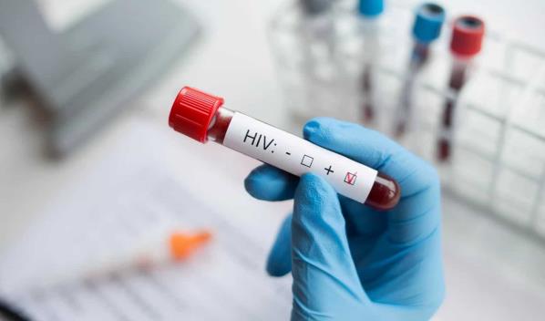 M&aacute;s de 16,000 personas con VIH perder&iacute;an su tratamiento en Florida por un recorte p&uacute;blico