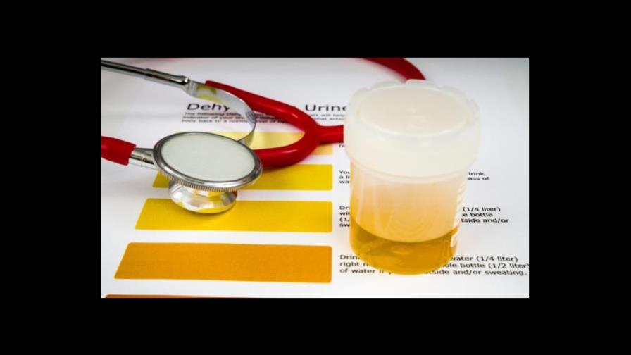 Cuándo debe preocuparte el color de la orina Cuándo debe preocuparte el color de la orina