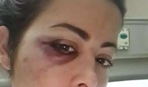 Dafne Guzm&aacute;n es sometida a operaci&oacute;n luego de caerse de su cama 