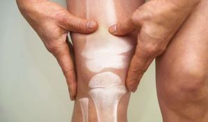 Cient&iacute;ficos de Florida descubren nueva forma de tratar la osteoporosis