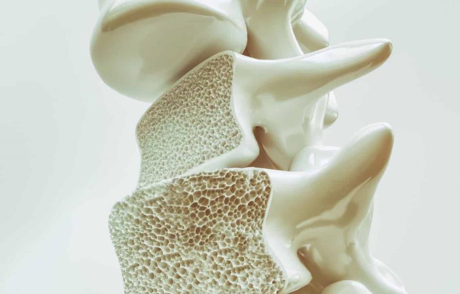 Científicos de Florida descubren nueva forma de tratar la osteoporosis