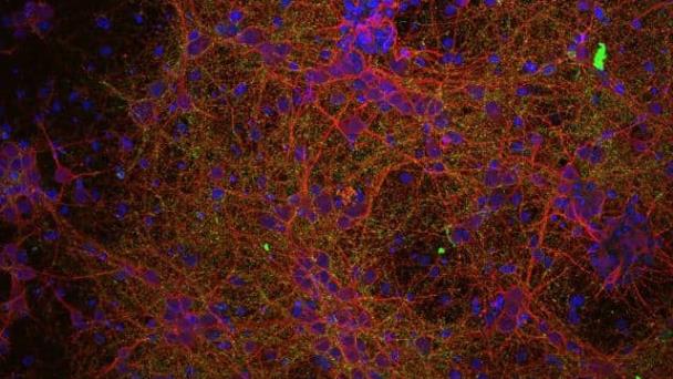 La ciencia abre una prometedora vía para tratar la lesión medular