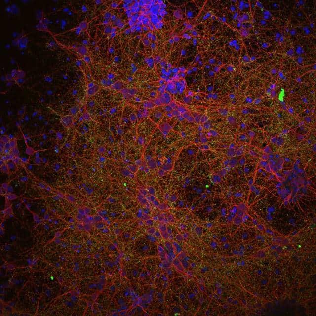 La ciencia abre una prometedora vía para tratar la lesión medular