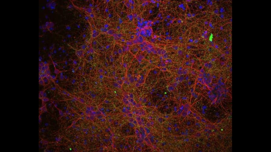 La ciencia abre una prometedora vía para tratar la lesión medular